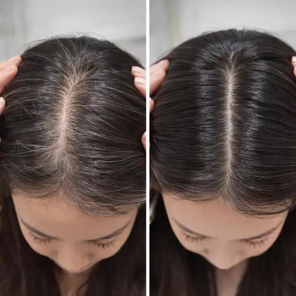 Zenvia Herbal Hair Oil